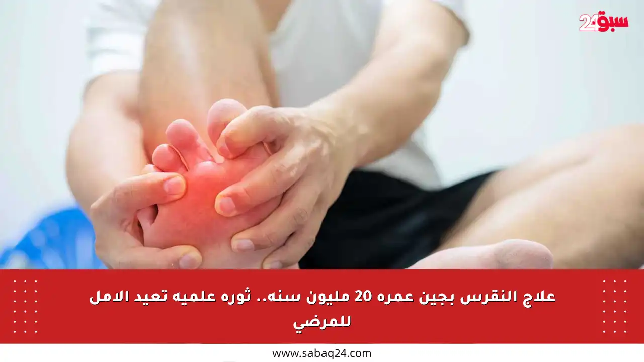 علاج النقرس بجين عمره 20 مليون سنة.. ثورة علمية تعيد الأمل للمرضى